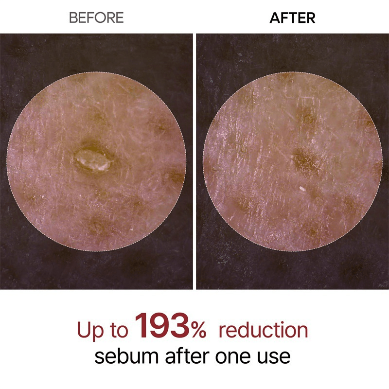 Extract & Smooth Rice Ampoule