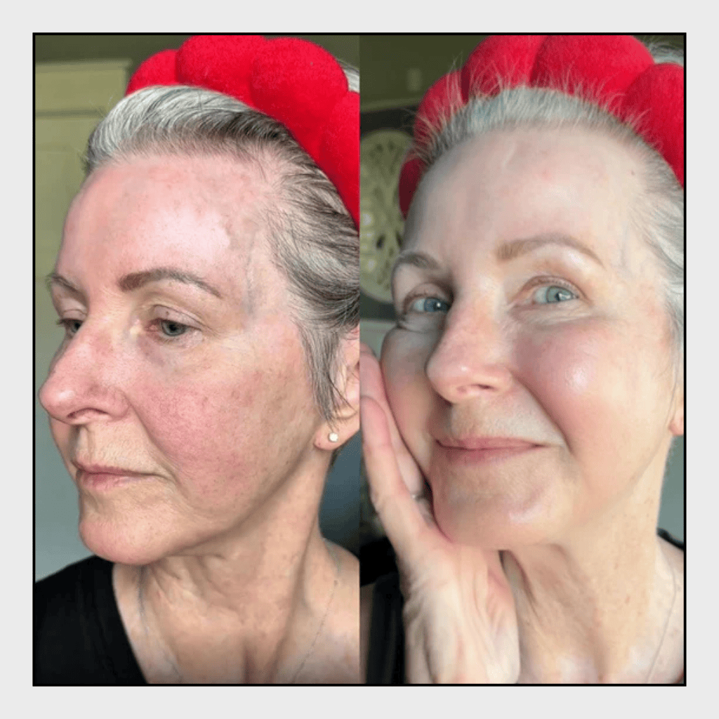 Bioactive Prebiotics Jelly Serum | versafynaturals