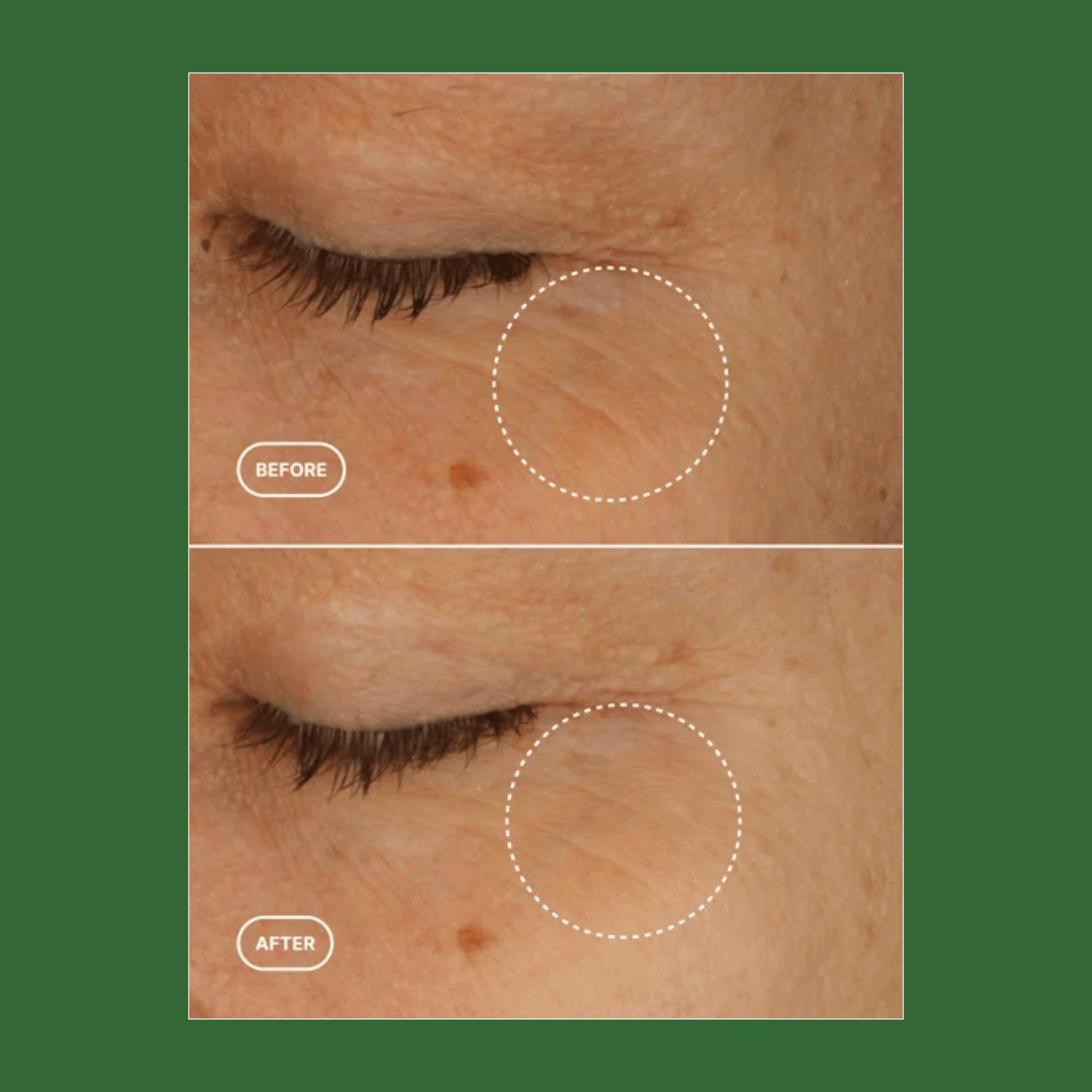 Bidens Pilosa Eye Serum | versafynaturals