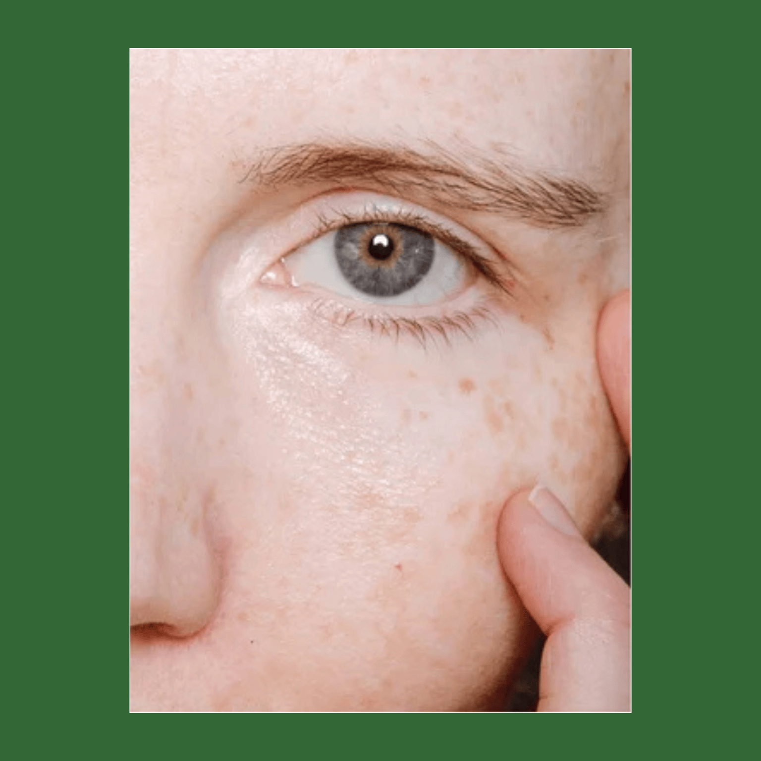 Bidens Pilosa Eye Serum | versafynaturals